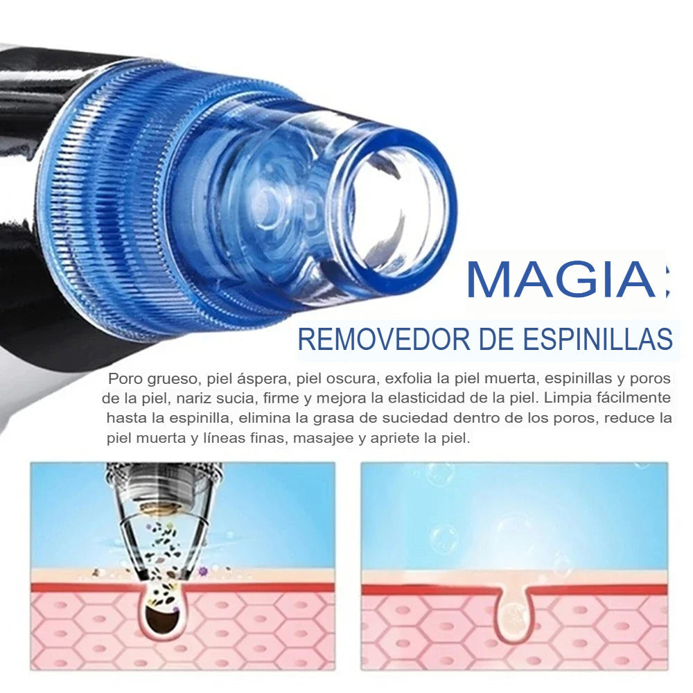 ✨ Removedor Eléctrico de Comedones por Succión a Vacío – Tu spa facial en casa ✨