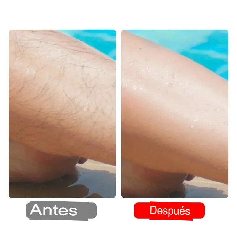 ✨Depiladora de Fricción de Cristal | ¡Piel Suave Sin Dolor!💖🪒