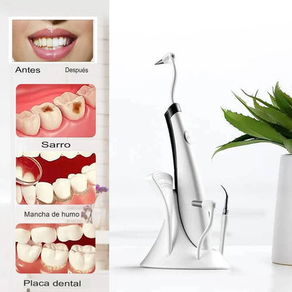 🦷Limpiador Dental Ultrasónico 5 en 1 con Luz LED | Elimina Placa, Sarro y Manchas💎