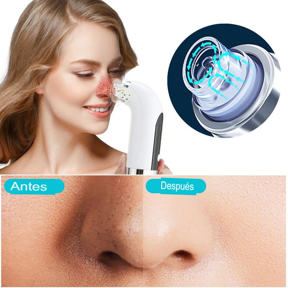 🫧Limpiador Facial Tratamiento de Burbujas | ¡Revoluciona Tu Rutina de Cuidado Facial con Microbolhas!🌿