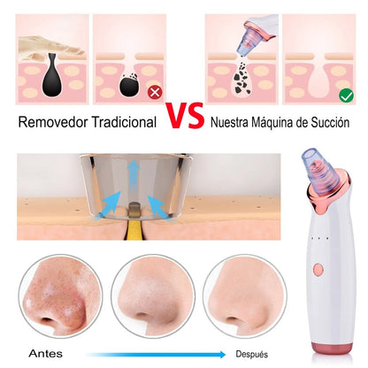 💧Removedor de Puntos Negros y Imperfecciones | Solución Profunda para una Piel Impecable🫧