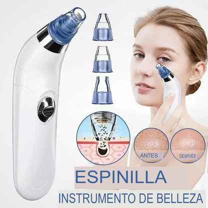 ✨ Removedor Eléctrico de Comedones por Succión a Vacío – Tu spa facial en casa ✨