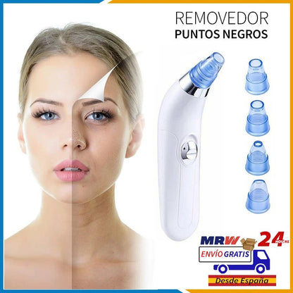 ✨ Removedor Eléctrico de Comedones por Succión a Vacío – Tu spa facial en casa ✨
