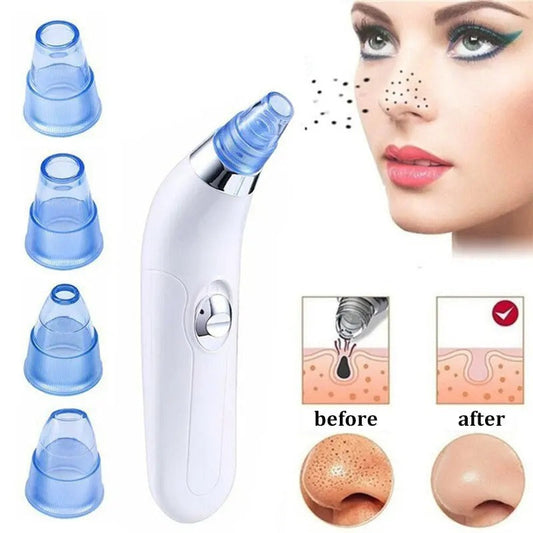 ✨ Removedor Eléctrico de Comedones por Succión a Vacío – Tu spa facial en casa ✨